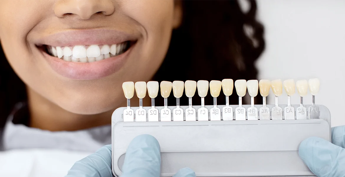 At-Home vs Professional Teeth Whitening Treatments - Lee Dental Centers