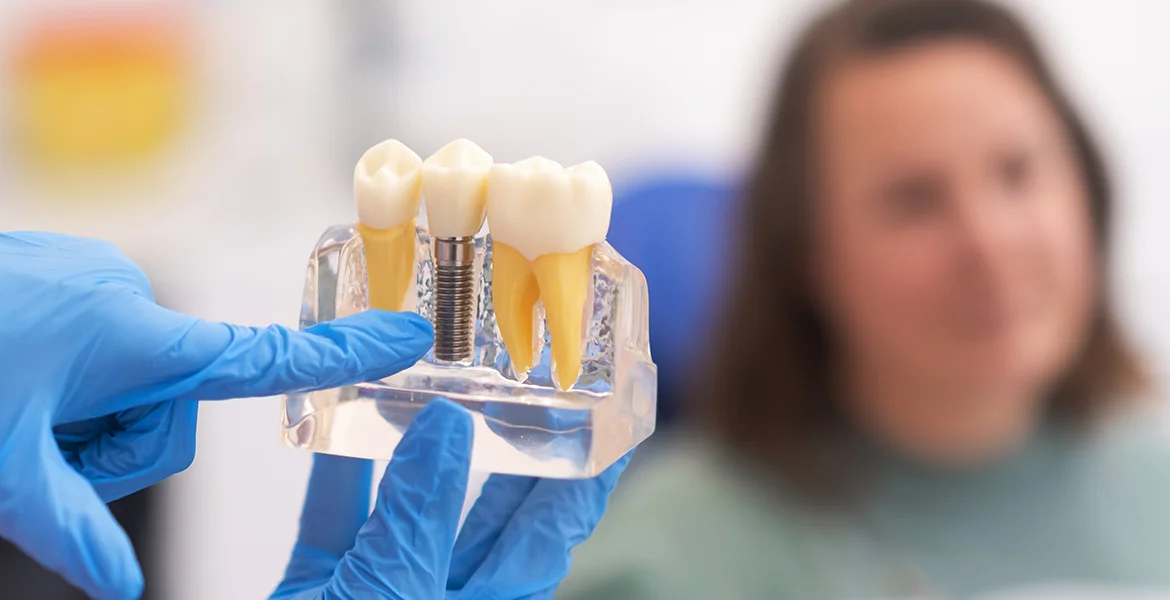 Who Is a Good Candidate for Dental Implants? - Lee Dental Centers